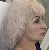 До
